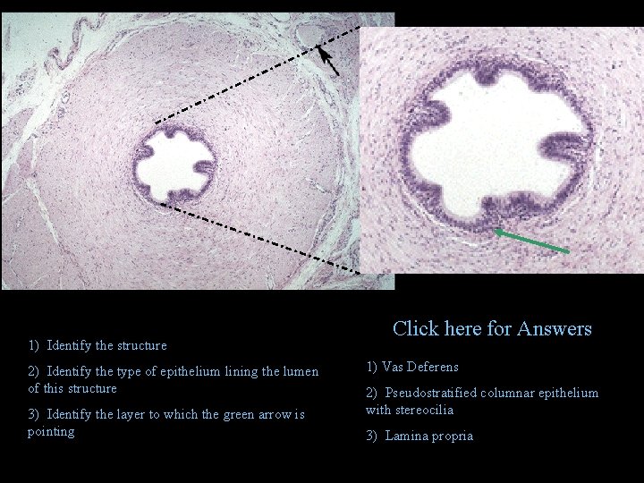 1) Identify the structure 2) Identify the type of epithelium lining the lumen of