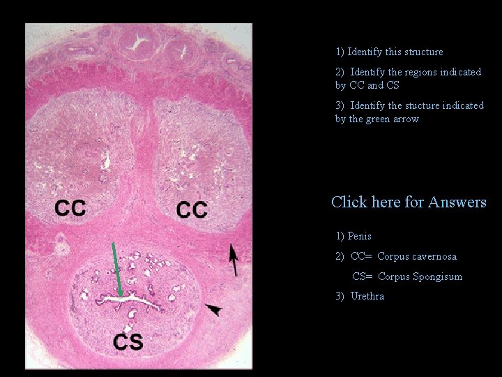 1) Identify this structure 2) Identify the regions indicated by CC and CS 3)