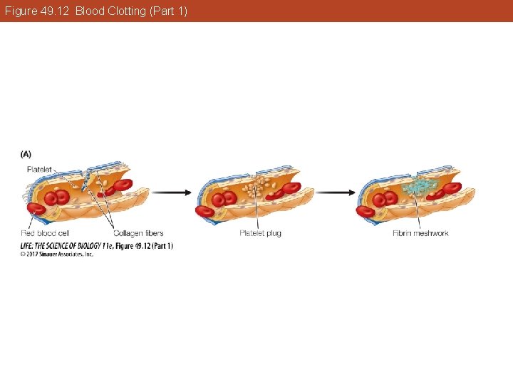 Figure 49. 12 Blood Clotting (Part 1) 