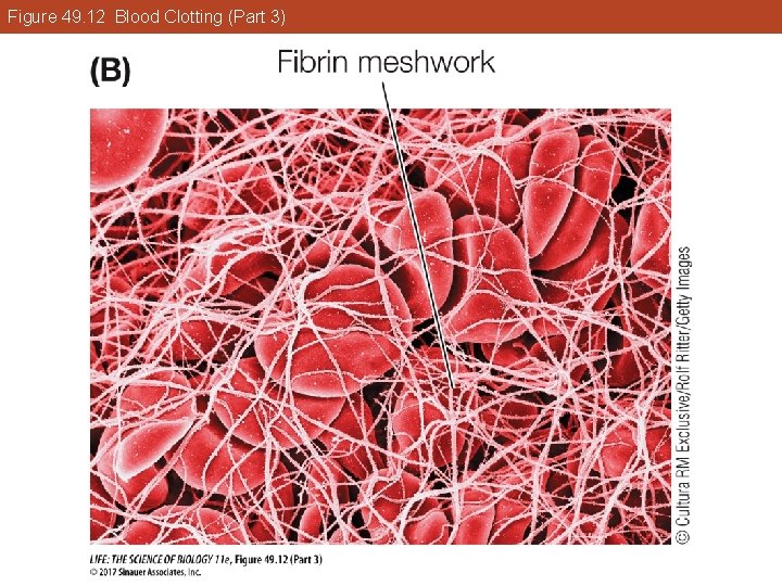 Figure 49. 12 Blood Clotting (Part 3) 