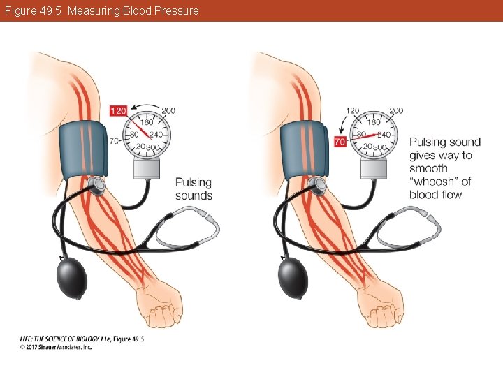 Figure 49. 5 Measuring Blood Pressure 