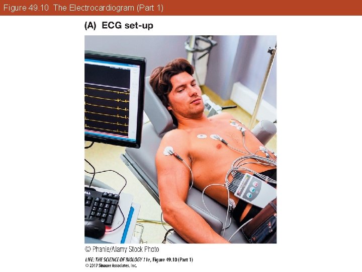 Figure 49. 10 The Electrocardiogram (Part 1) 
