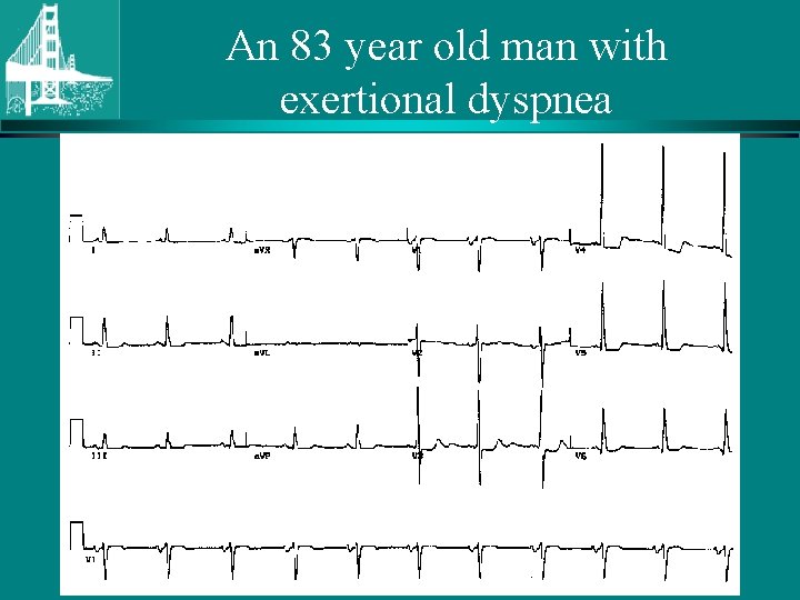 An 83 year old man with exertional dyspnea © Continuing Medical Implementation …. .