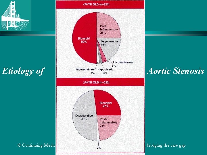 Etiology of © Continuing Medical Implementation Aortic Stenosis …. . . bridging the care