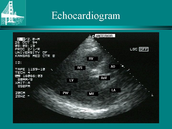 Echocardiogram © Continuing Medical Implementation …. . . bridging the care gap 