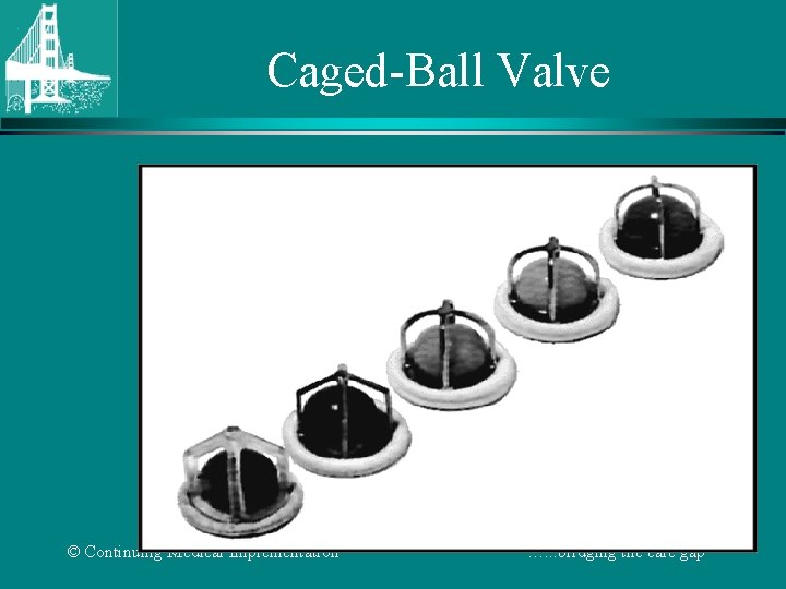 Caged-Ball Valve © Continuing Medical Implementation …. . . bridging the care gap 