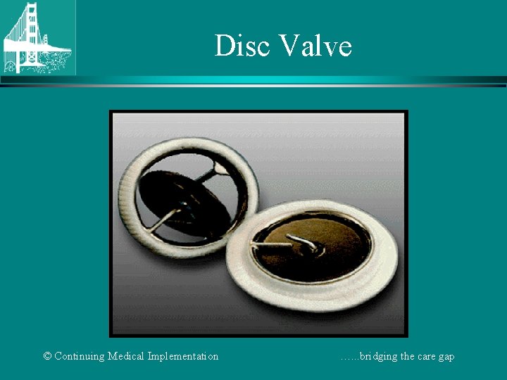 Disc Valve © Continuing Medical Implementation …. . . bridging the care gap 