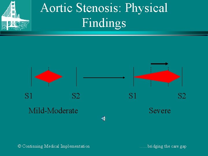 Aortic Stenosis: Physical Findings S 1 S 2 Mild-Moderate © Continuing Medical Implementation S