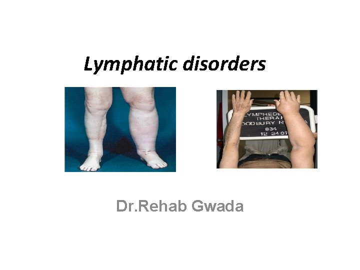 Lymphatic disorders Dr. Rehab Gwada 