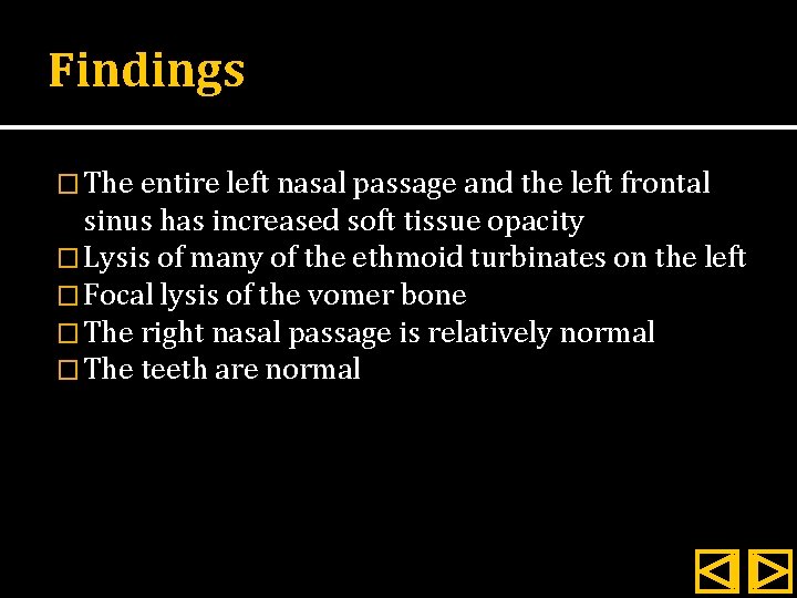 Findings � The entire left nasal passage and the left frontal sinus has increased