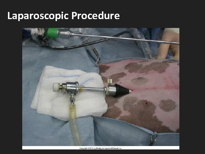 Laparoscopic Procedure 