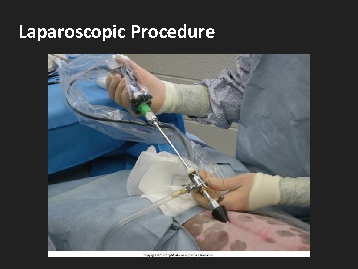 Laparoscopic Procedure 