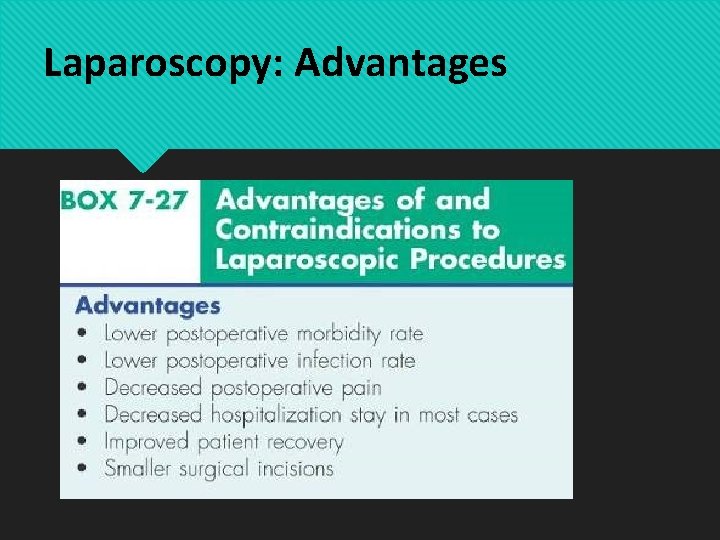 Laparoscopy: Advantages 
