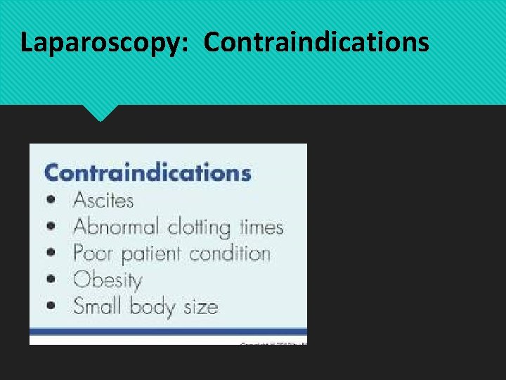 Laparoscopy: Contraindications 
