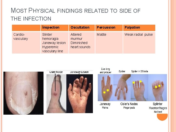 MOST PHYSICAL FINDINGS RELATED TO SIDE OF THE INFECTION Cardiovasculary İnspection Oscultation Percussion Palpation