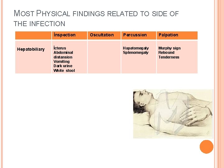 MOST PHYSICAL FINDINGS RELATED TO SIDE OF THE INFECTION İnspection Hepatobiliary İcterus Abdominal distansion