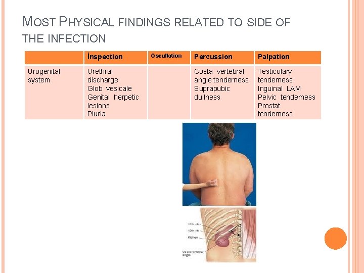 MOST PHYSICAL FINDINGS RELATED TO SIDE OF THE INFECTION İnspection Urogenital system Urethral discharge
