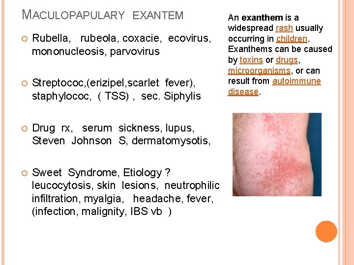 MACULOPAPULARY EXANTEM Rubella, rubeola, coxacie, ecovirus, mononucleosis, parvovirus Streptococ, (erizipel, scarlet fever), staphylococ, (