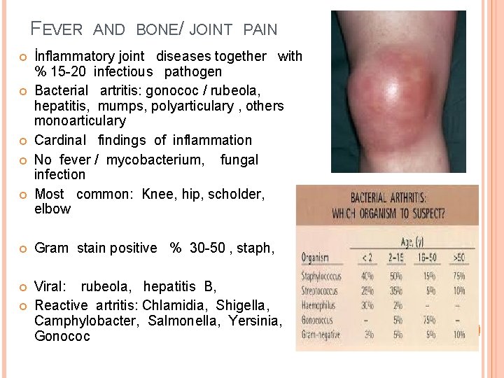 FEVER AND BONE/ JOINT PAIN İnflammatory joint diseases together with % 15 -20 infectious