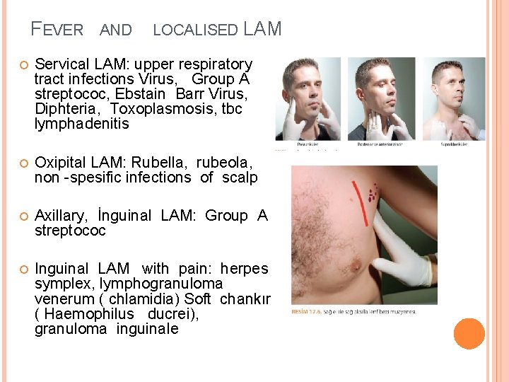 FEVER AND LOCALISED LAM Servical LAM: upper respiratory tract infections Virus, Group A streptococ,