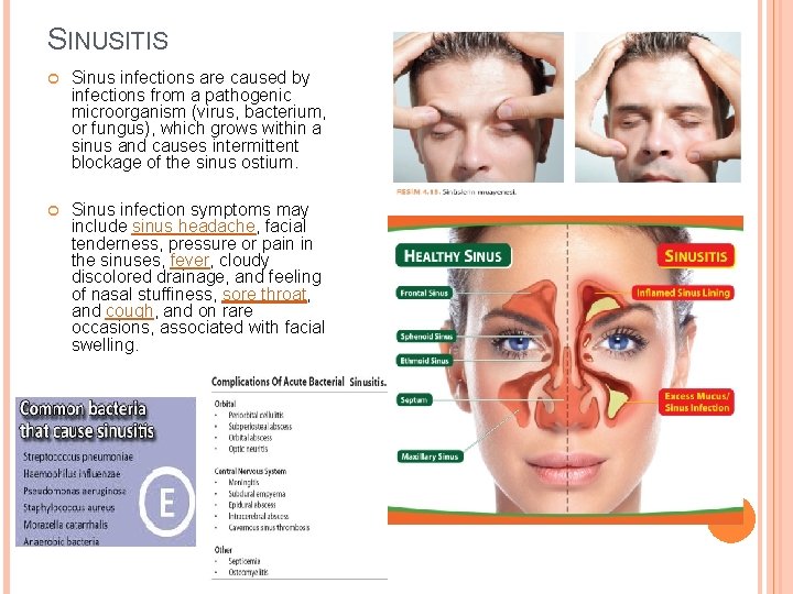 SINUSITIS Sinus infections are caused by infections from a pathogenic microorganism (virus, bacterium, or