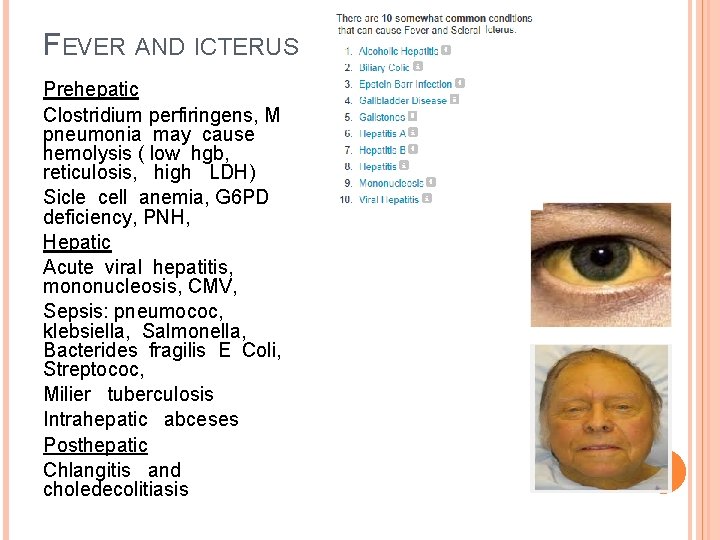 FEVER AND ICTERUS Prehepatic Clostridium perfiringens, M pneumonia may cause hemolysis ( low hgb,