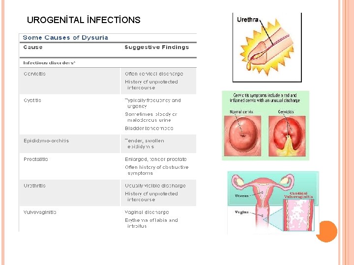 UROGENİTAL İNFECTİONS 