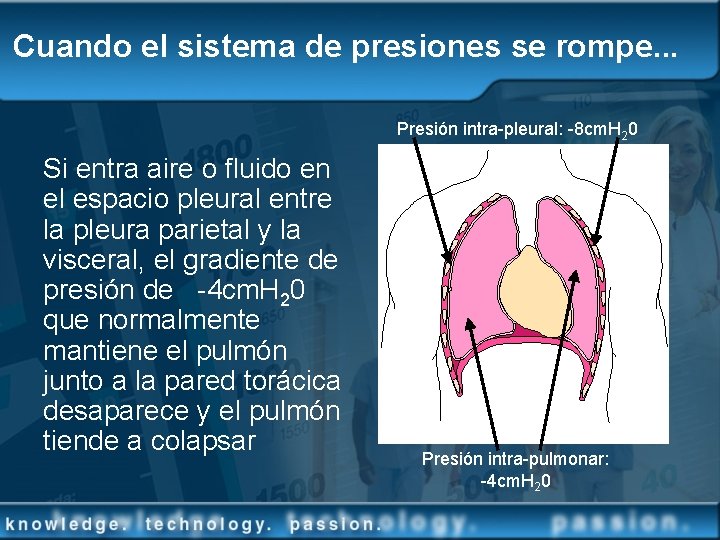 Cuando el sistema de presiones se rompe. . . Presión intra-pleural: -8 cm. H