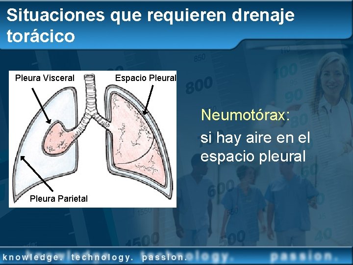 Situaciones que requieren drenaje torácico Pleura Visceral Espacio Pleural Neumotórax: si hay aire en