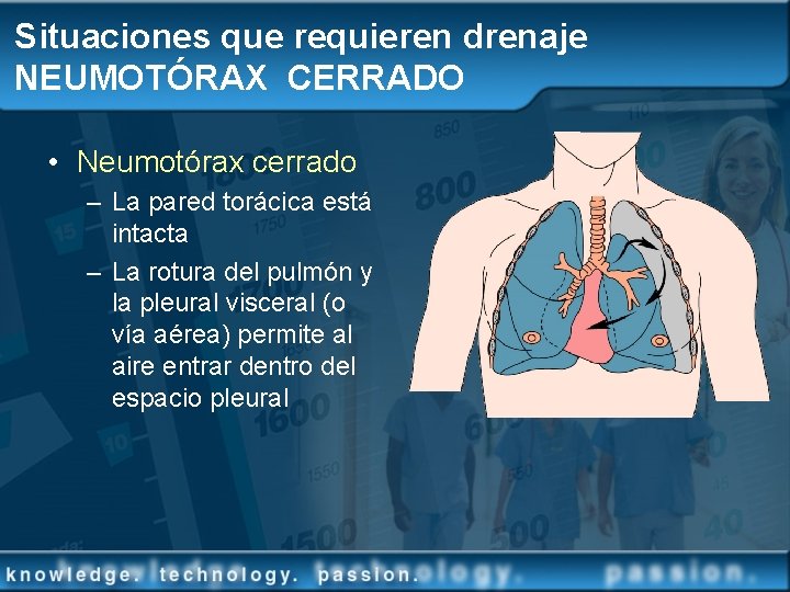 Situaciones que requieren drenaje NEUMOTÓRAX CERRADO • Neumotórax cerrado – La pared torácica está