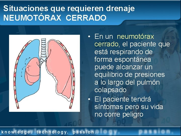 Situaciones que requieren drenaje NEUMOTÓRAX CERRADO • En un neumotórax cerrado, el paciente que