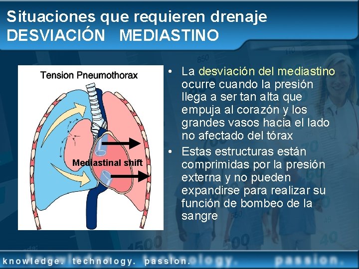 Situaciones que requieren drenaje DESVIACIÓN MEDIASTINO Mediastinal shift • La desviación del mediastino ocurre