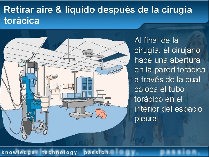 Retirar aire & líquido después de la cirugía torácica Al final de la cirugía,