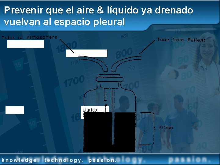 Prevenir que el aire & líquido ya drenado vuelvan al espacio pleural Líquido drenado