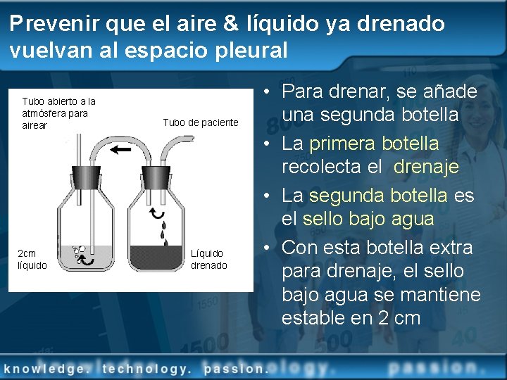 Prevenir que el aire & líquido ya drenado vuelvan al espacio pleural Tubo abierto