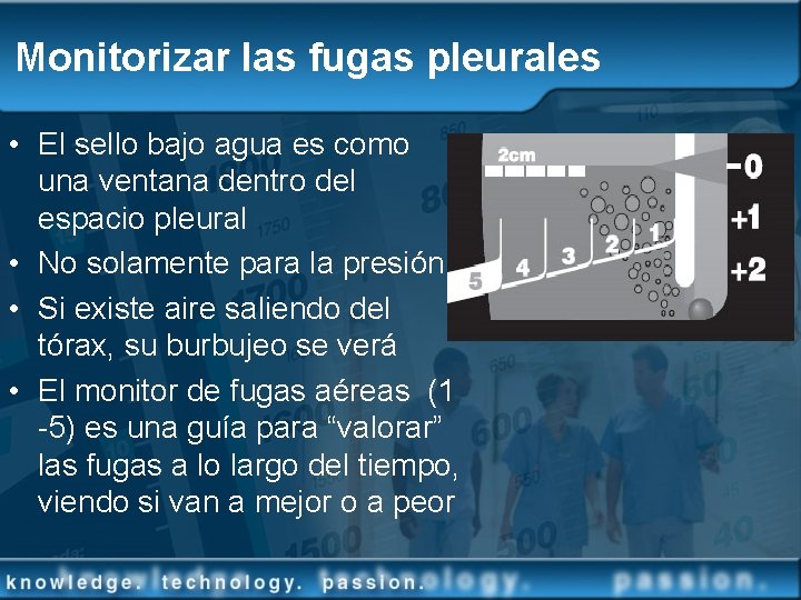 Monitorizar las fugas pleurales • El sello bajo agua es como una ventana dentro