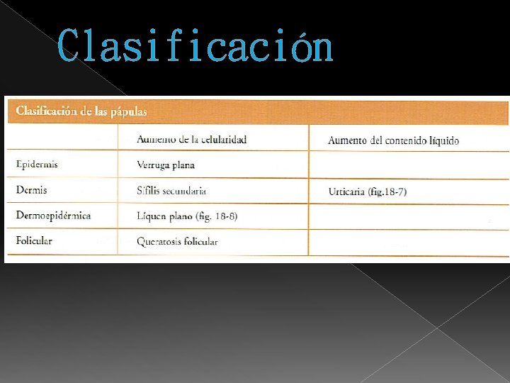 Clasificación 