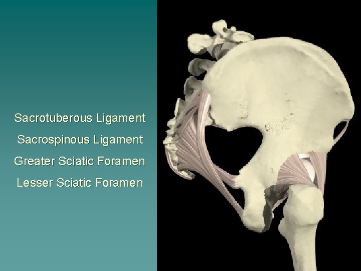 Sacrotuberous Ligament Sacrospinous Ligament Greater Sciatic Foramen Lesser Sciatic Foramen 