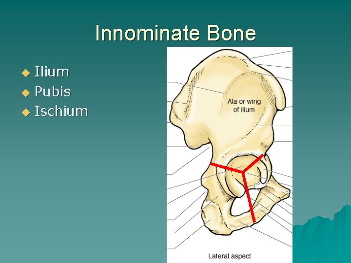 Innominate Bone Ilium u Pubis u Ischium u 