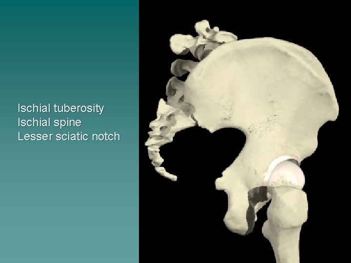 Ischial tuberosity Ischial spine Lesser sciatic notch 