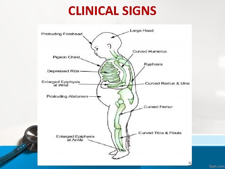 CLINICAL SIGNS CLINICAL SIGNS