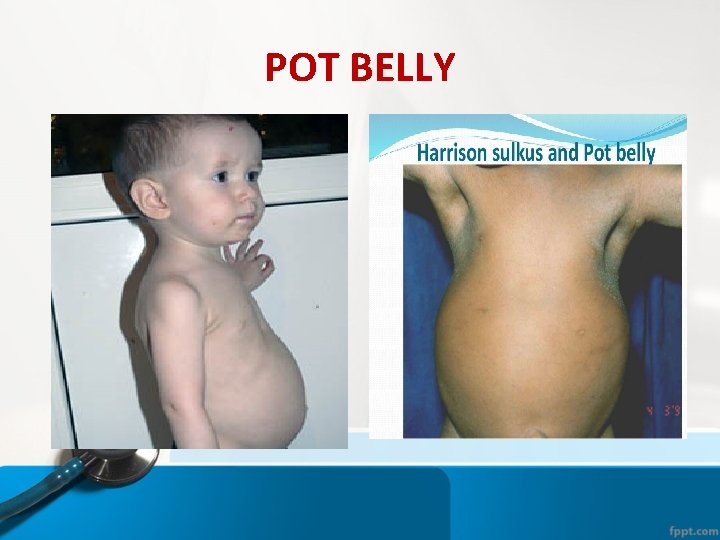 POT BELLY POT BELLY