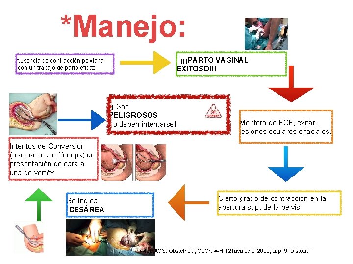 *Manejo: Ausencia de contracción pelviana con un trabajo de parto eficaz ¡¡¡PARTO VAGINAL EXITOSO!!! *Manejo: Ausencia de contracción pelviana con un trabajo de parto eficaz ¡¡¡PARTO VAGINAL EXITOSO!!!