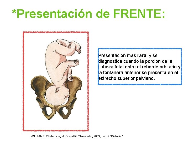 *Presentación de FRENTE: Presentación más rara, y se diagnostica cuando la porción de la *Presentación de FRENTE: Presentación más rara, y se diagnostica cuando la porción de la