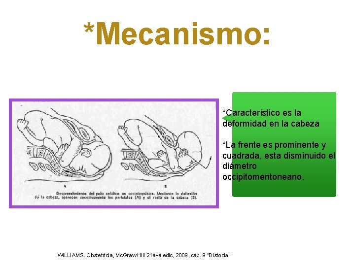*Mecanismo: *Característico es la deformidad en la cabeza *La frente es prominente y cuadrada, *Mecanismo: *Característico es la deformidad en la cabeza *La frente es prominente y cuadrada,