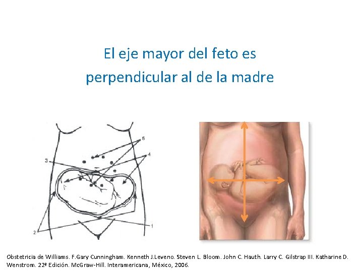 El eje mayor del feto es perpendicular al de la madre Obstetricia de Williams. El eje mayor del feto es perpendicular al de la madre Obstetricia de Williams.