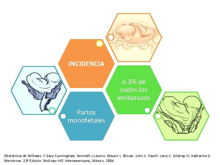 INCIDENCIA o. 3% de todos los embarazos Partos monofetales Obstetricia de Williams. F. Gary INCIDENCIA o. 3% de todos los embarazos Partos monofetales Obstetricia de Williams. F. Gary