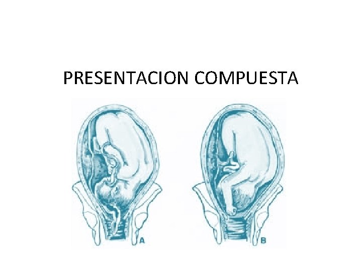 PRESENTACION COMPUESTA PRESENTACION COMPUESTA