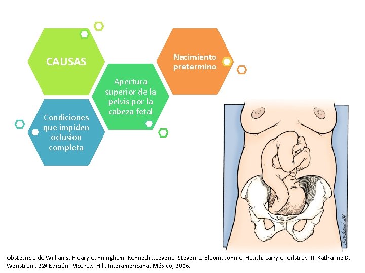 Nacimiento pretermino CAUSAS Condiciones que impiden oclusion completa Apertura superior de la pelvis por Nacimiento pretermino CAUSAS Condiciones que impiden oclusion completa Apertura superior de la pelvis por