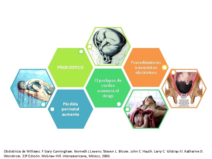 Procedimientos traumáticos obstétricos PRONOSTICO El prolapso de cordón aumenta el riesgo Pérdida perinatal aumenta Procedimientos traumáticos obstétricos PRONOSTICO El prolapso de cordón aumenta el riesgo Pérdida perinatal aumenta